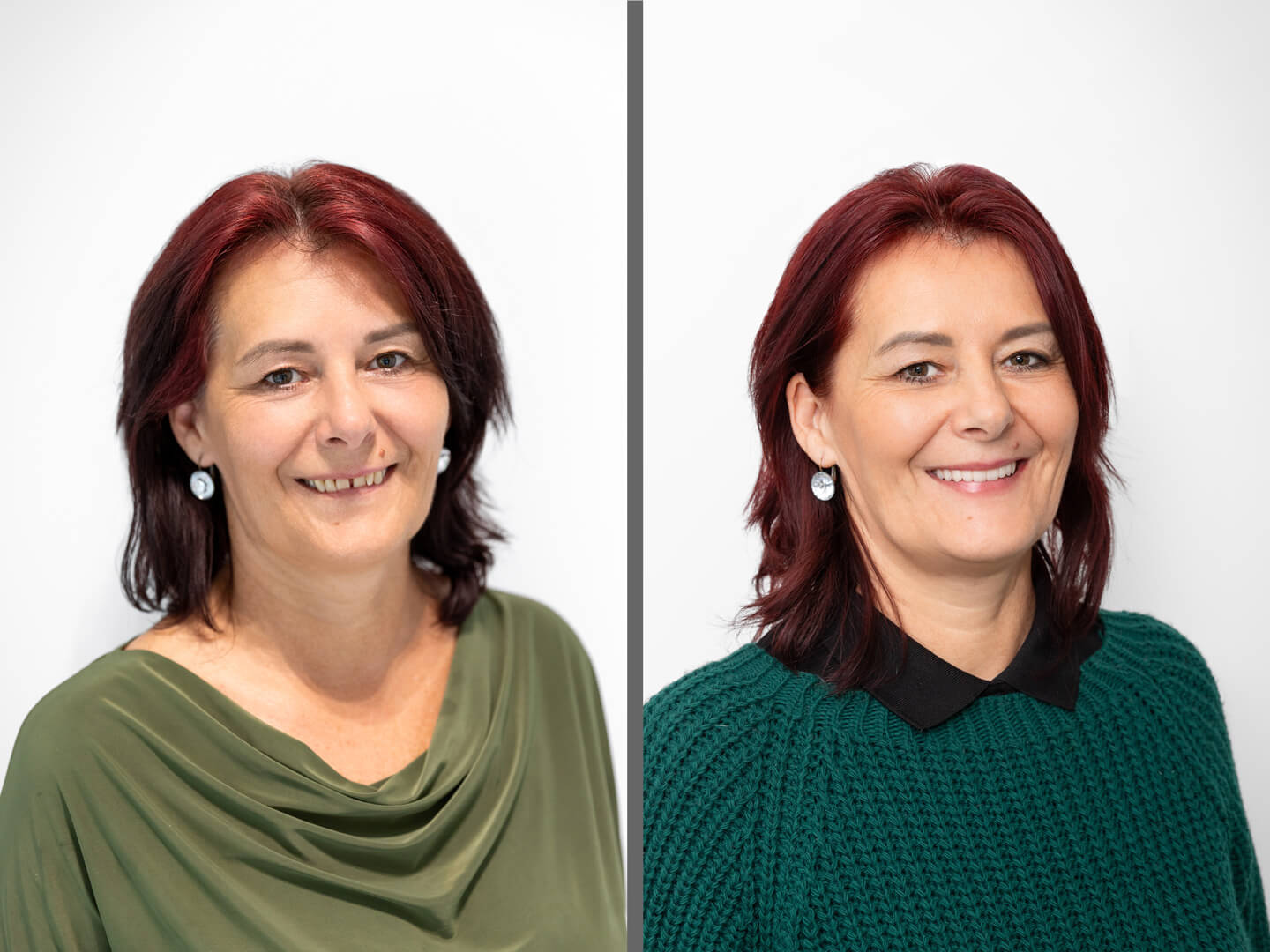 Zsuzsa — fogimplantátum kezelés előtte és utána a Profidentnél
